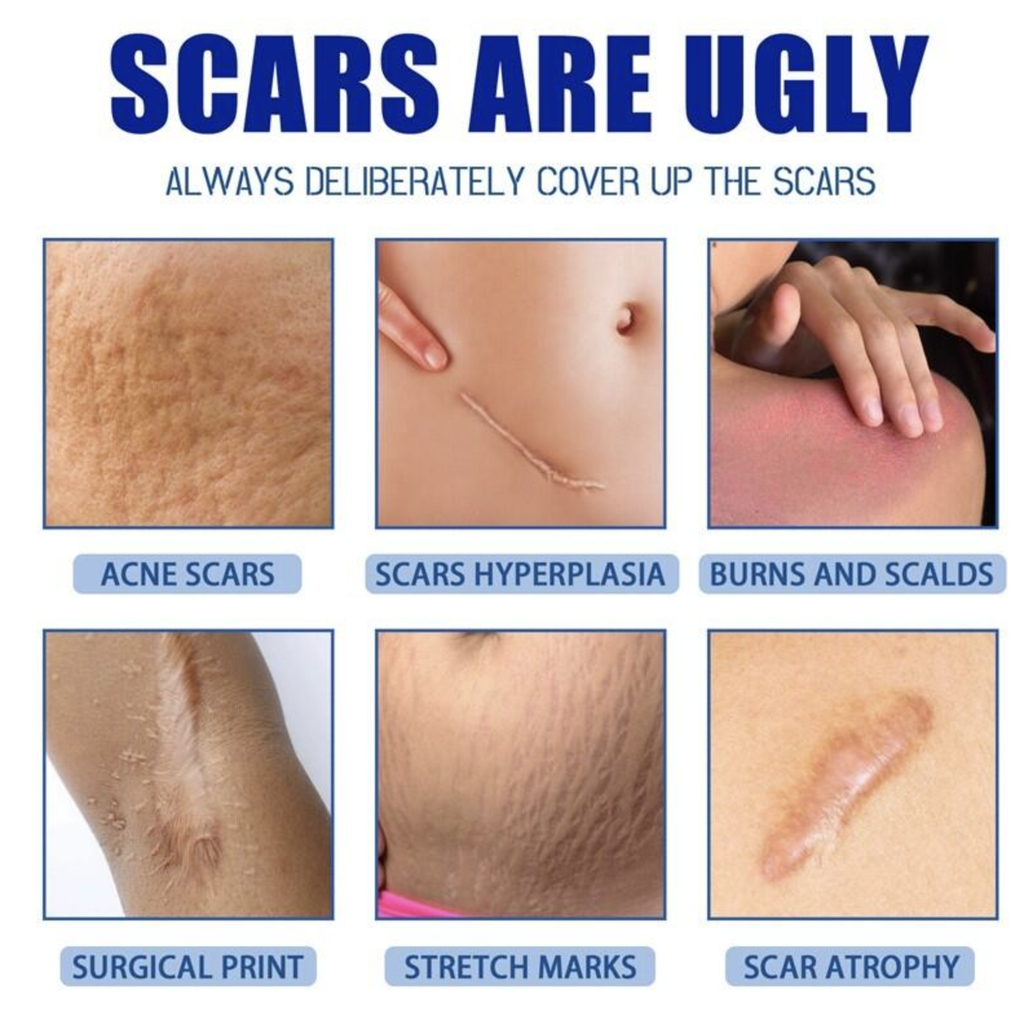 JAYSUING Scar Removal Cream 30g