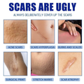 JAYSUING Scar Removal Cream 30g