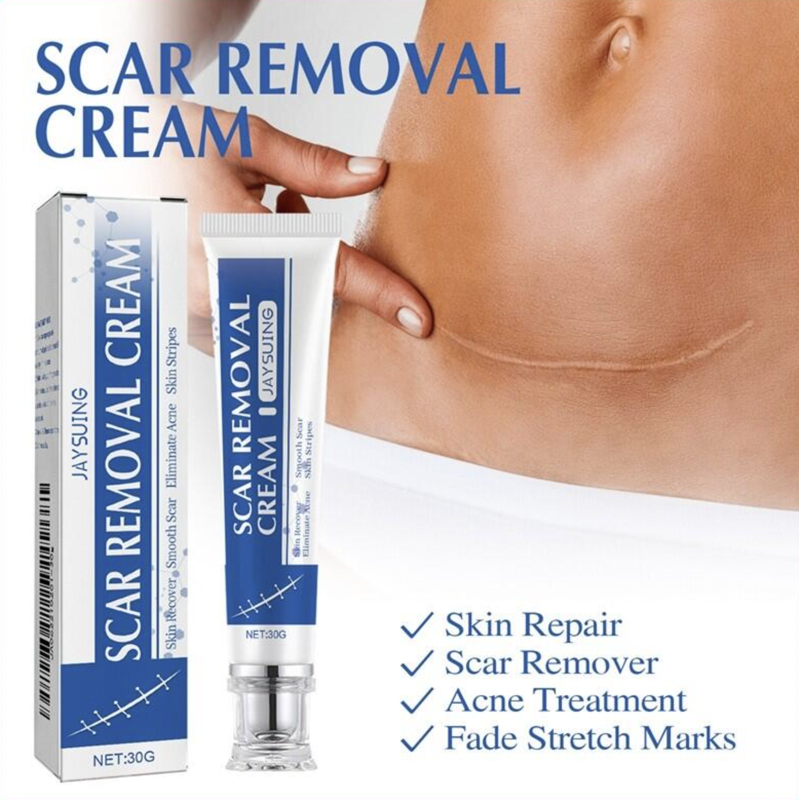 JAYSUING Scar Removal Cream 30g